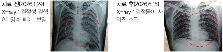 뉴스