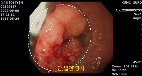 뉴스