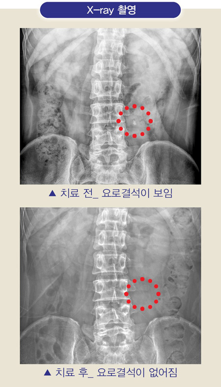 뉴스